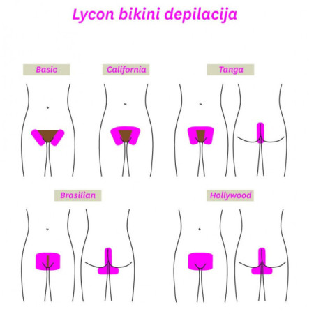 DEPILACIJA z LYCON VOSKI-2