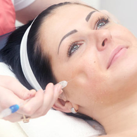 Meso-Jetpeel whithening