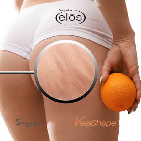 PAKET 3x ANTICELULIT VELASHAPE