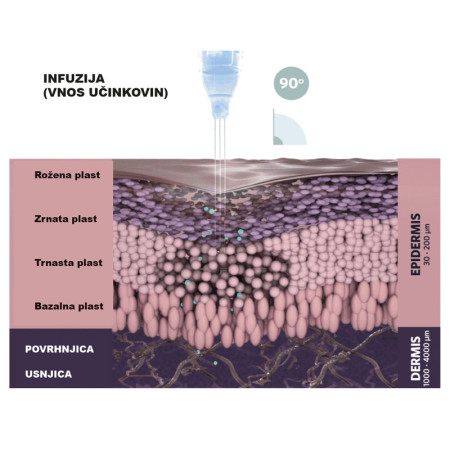 jetpeel-infuzija-eksosomi-plast-koze