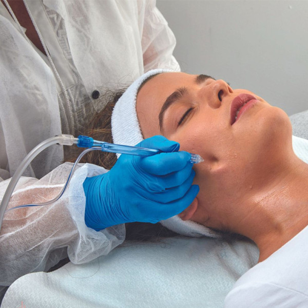 EKSOSOMI IN RASTNI FAKTORJI - MESO-JET-PEEL