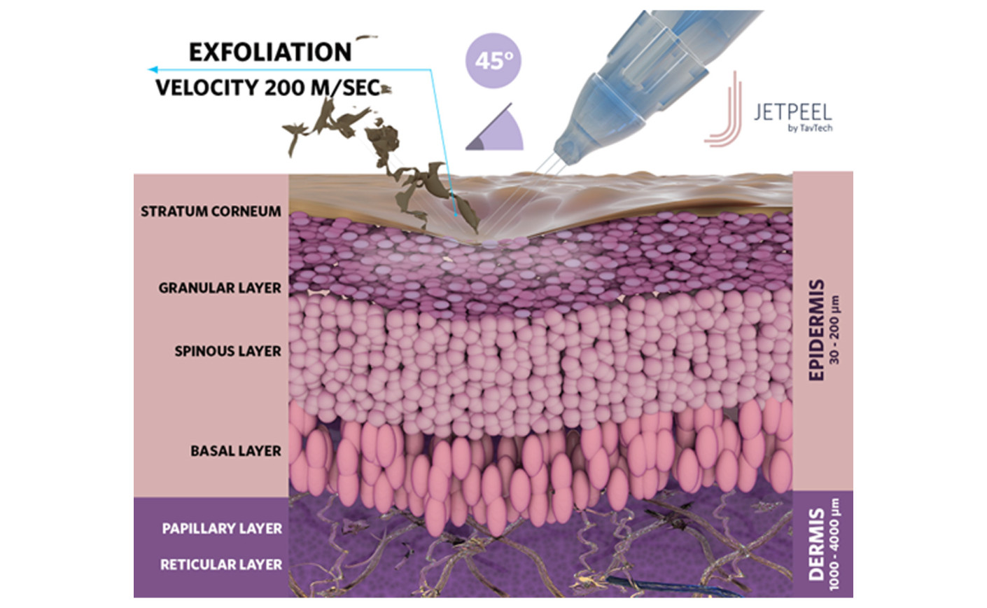 Hydrafacial JET PEEL